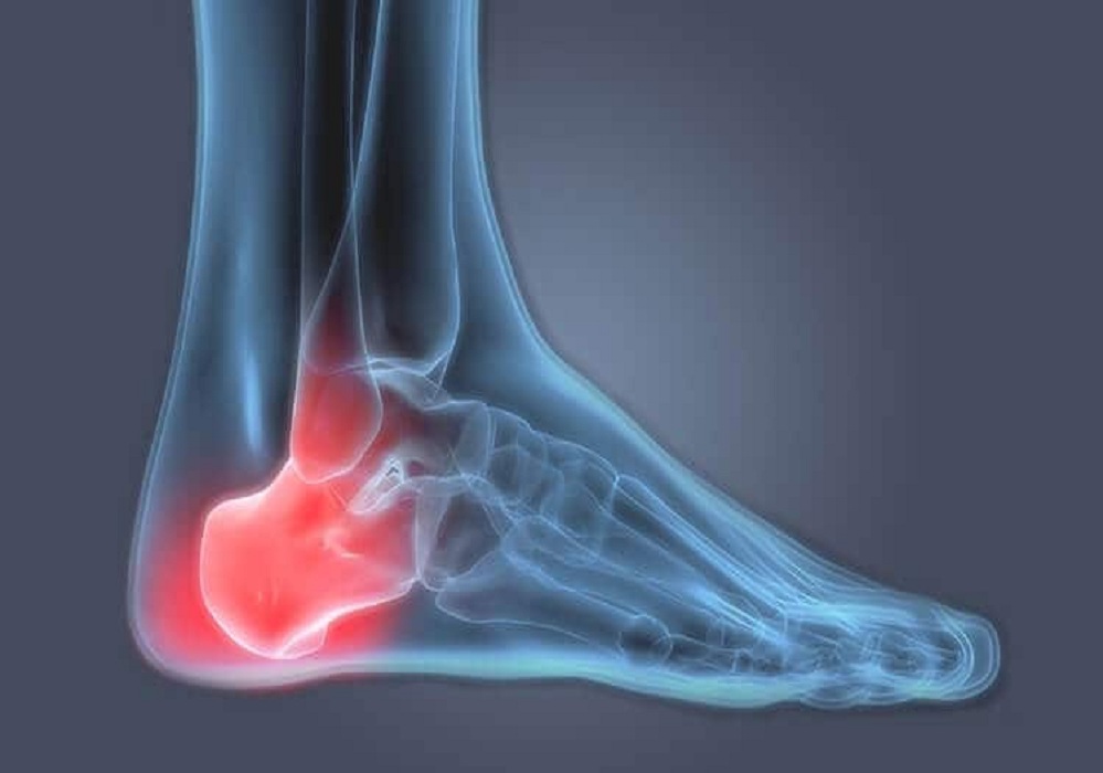 Determination for Sports Injury Treatment Houston! Receive the best support today!