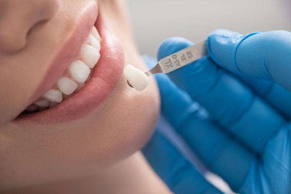 Sexton Dental Clinic : Your Guide to a Perfect Smile!